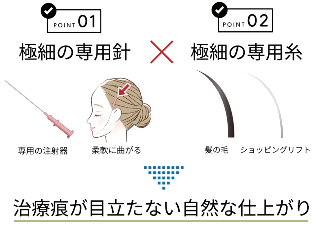 ショッピングリフトのメリット