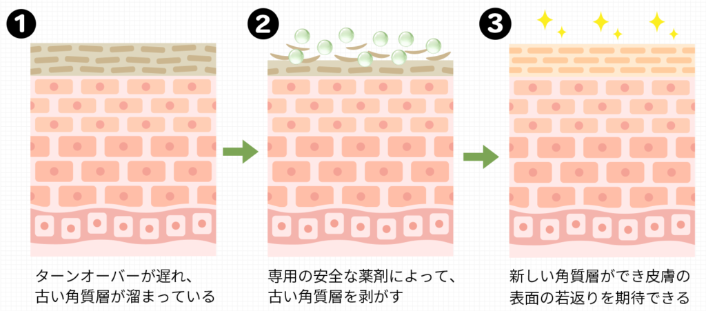 ピーリングの仕組み