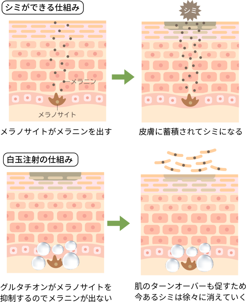 白玉注射の仕組み