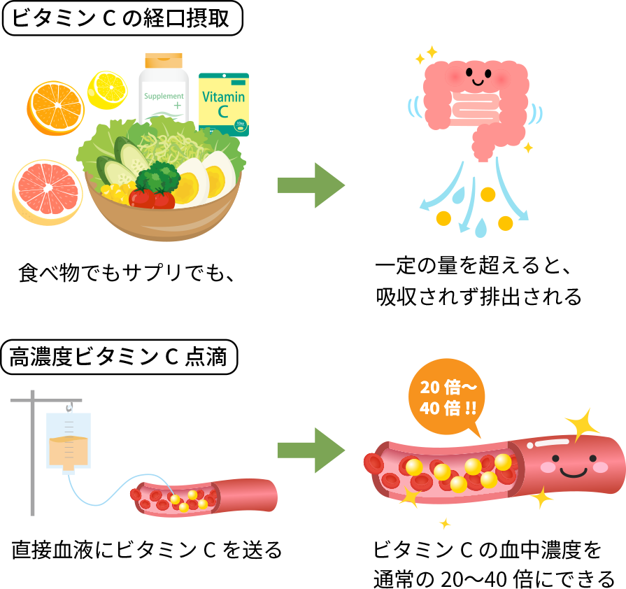 高濃度ビタミンC点滴の仕組み