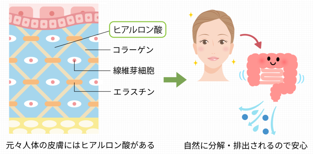 貴族フィラーの安全性