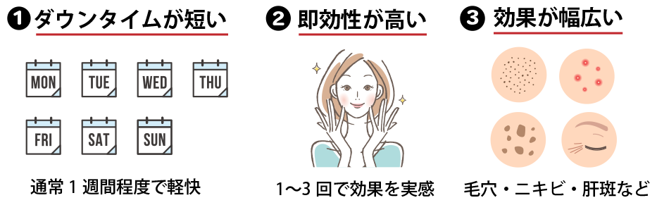 ポテンツァのメリット・デメリット