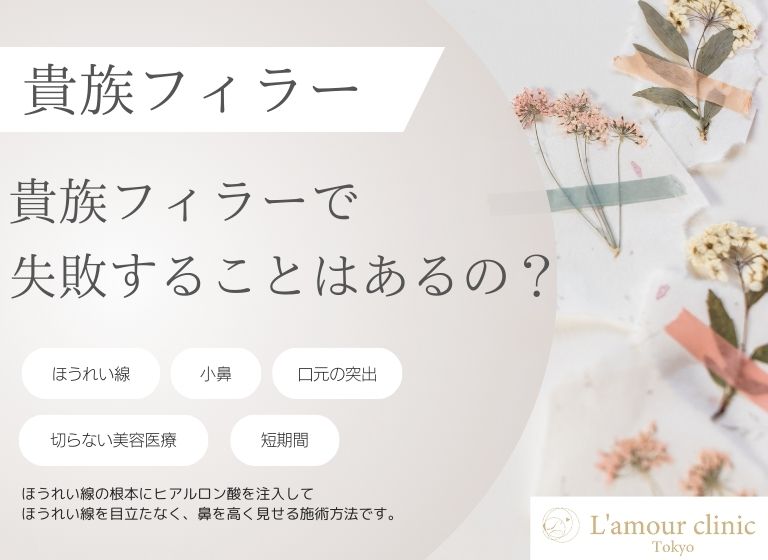 貴族フィラーで失敗することはあるの？｜失敗事例や予防ポイントを紹介