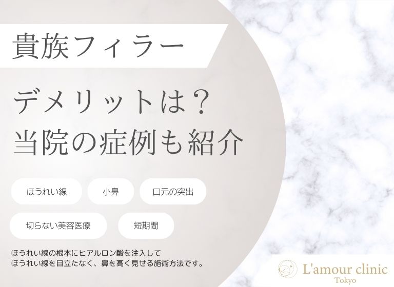 貴族フィラー施術のデメリット｜回避方法や当院の施術症例も紹介