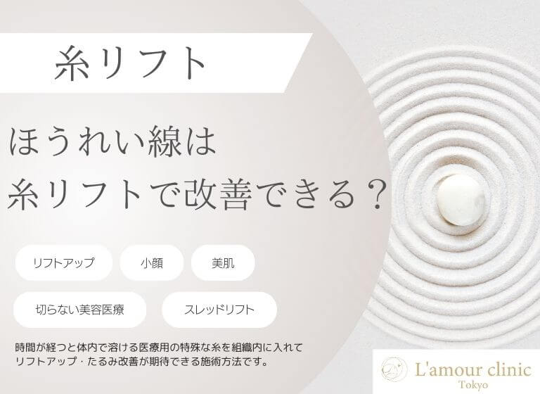 ほうれい線は糸リフトで改善できる？｜治療の仕組みとデメリット解説