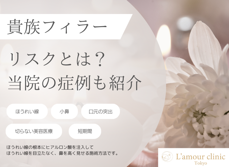 貴族フィラーのリスクとは？｜原因やデメリットを抑えるポイントを解説