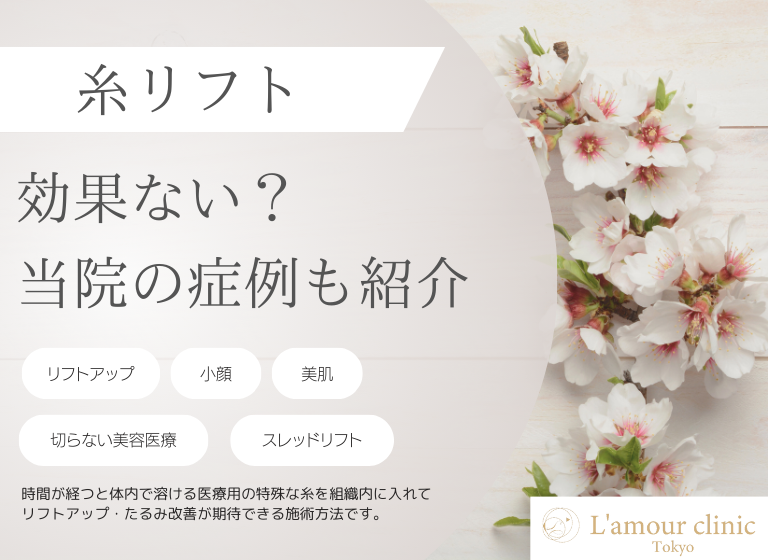 糸リフトは効果ない？｜カウンセリングの心構え・当院の施術事例